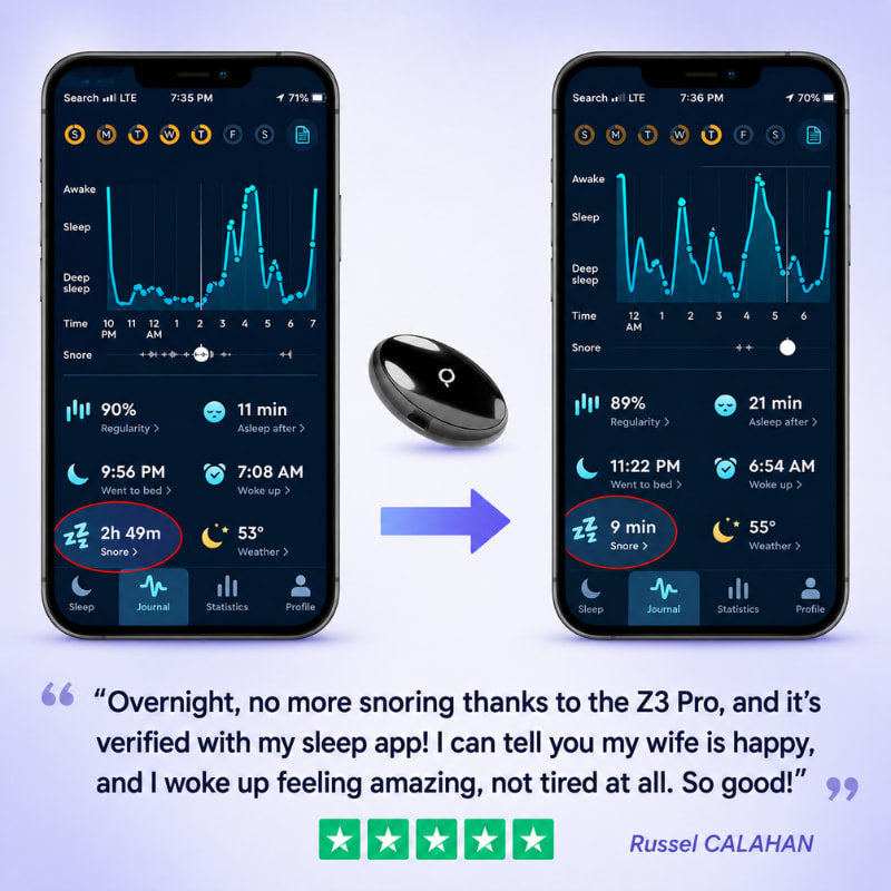 Z3 Pro® | Smart EMS Sleep Device