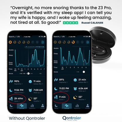 Z3 Pro | Advanced Anti-Snoring Device (10 patches included)