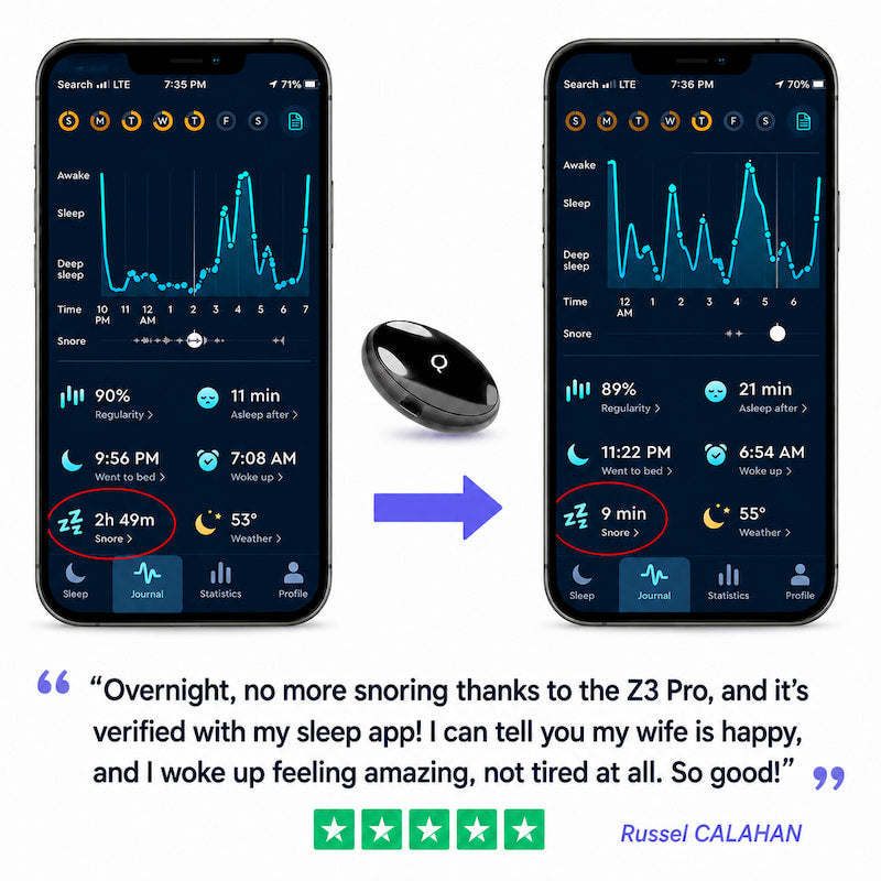 Z3 Pro® | Smart EMS Sleep Device